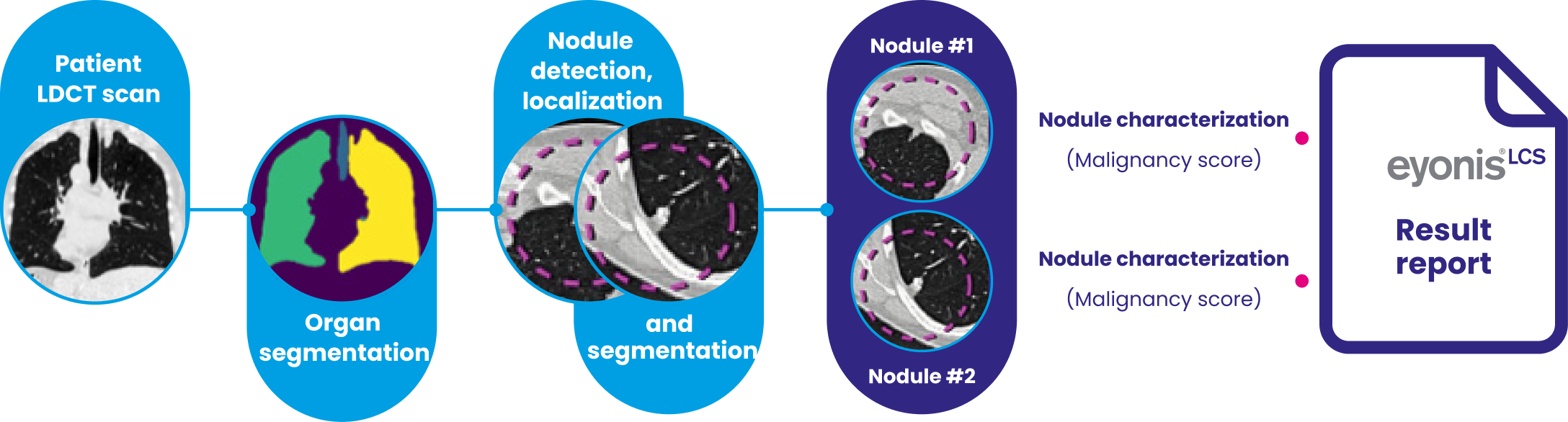 graph showing the eyonis LCS processing chain