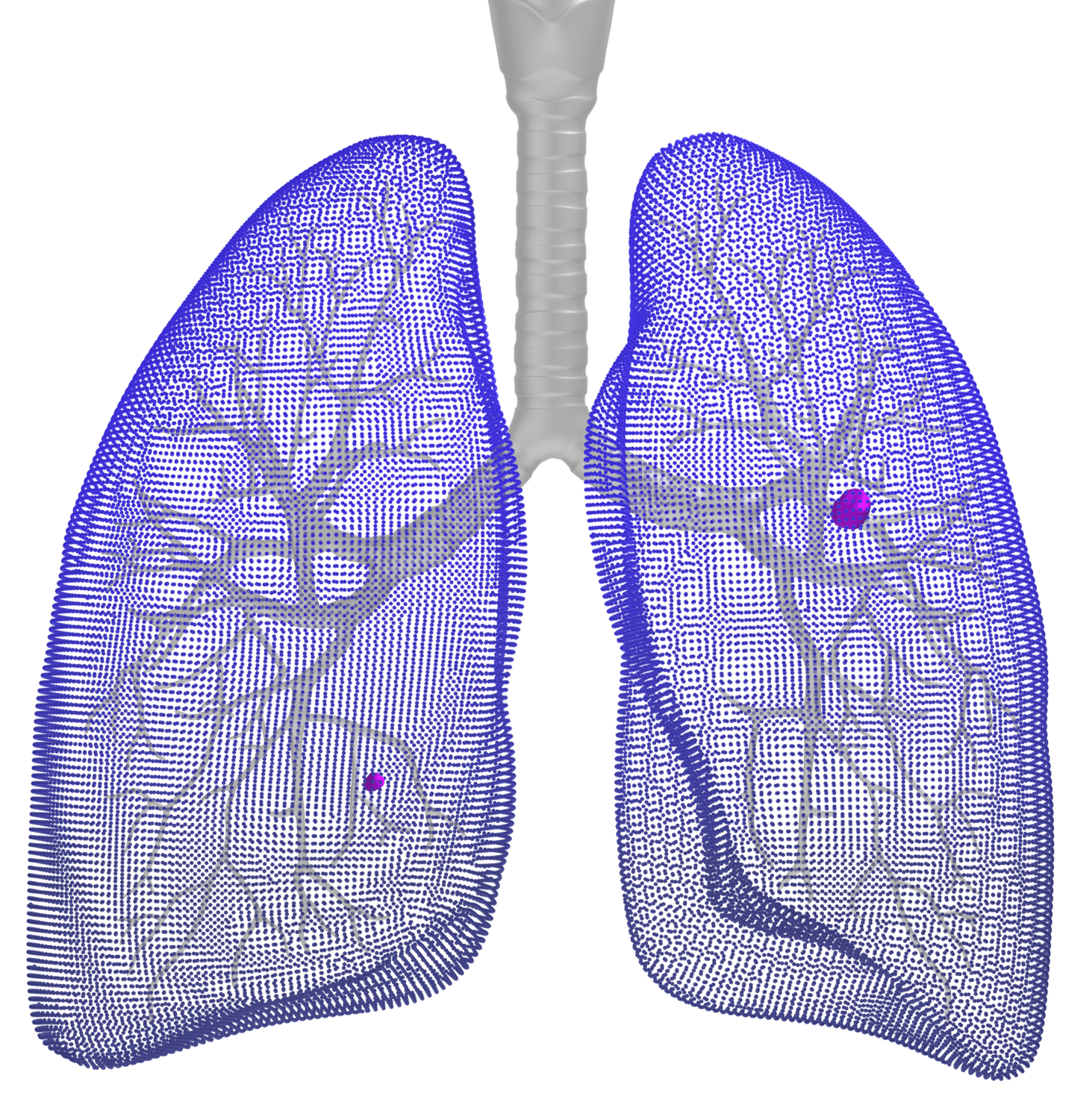 abstract image of 3D lungs with highlighted nodules